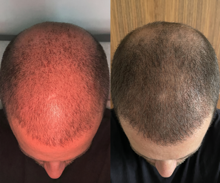 Works for Hair Growth too!