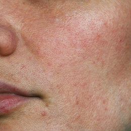 Uneven Texture