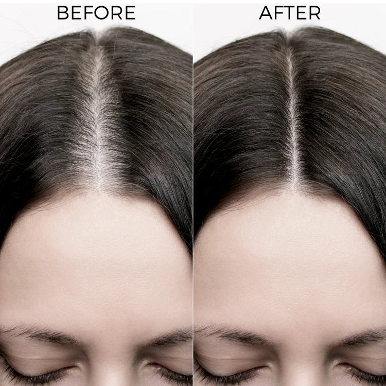 GHK-Cu Peptide Hair Regrowth Kit