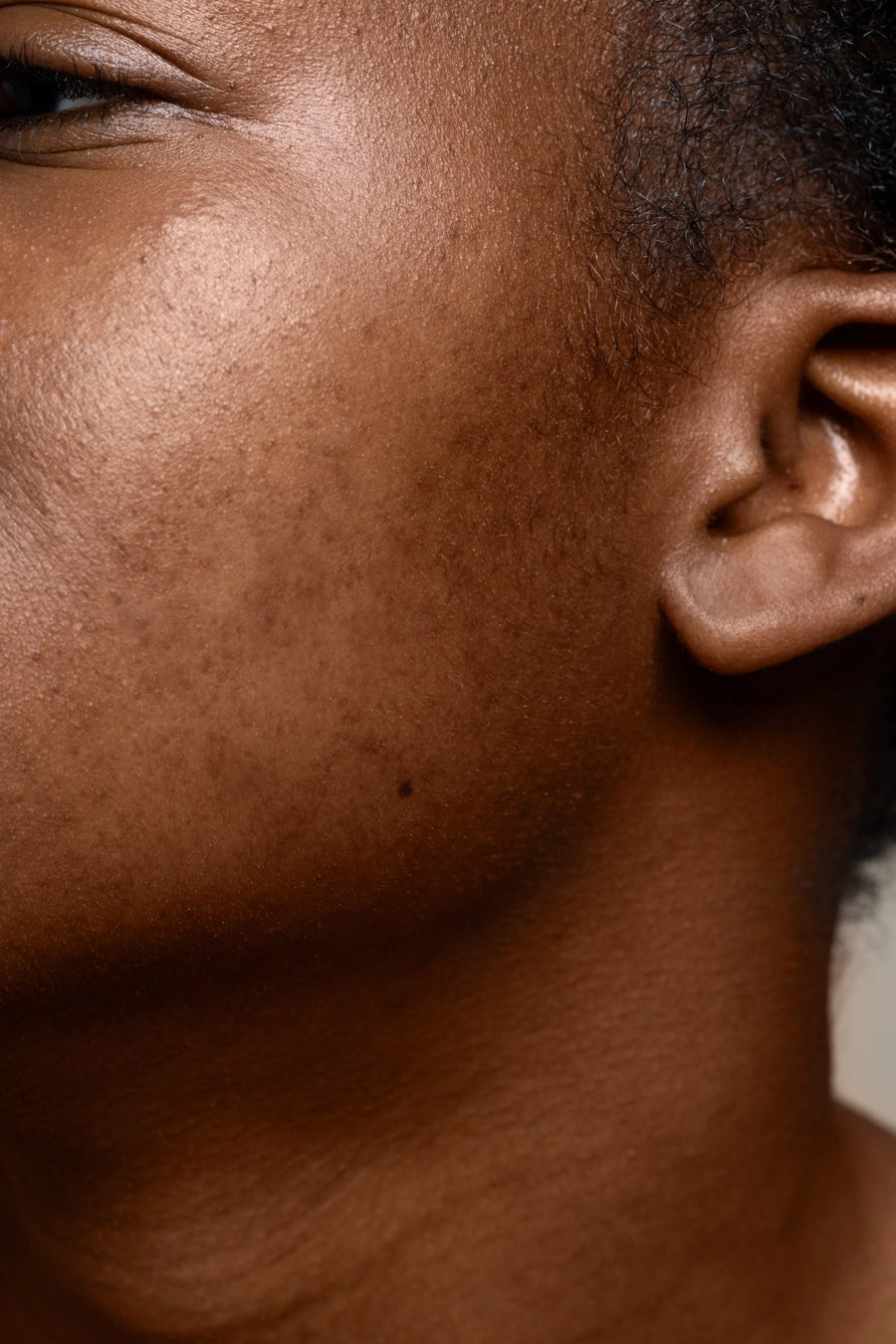 UNEVEN SKIN TONE